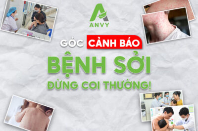 Cảnh báo về bệnh SỞI – Cùng Anvy phòng tránh ngay hôm nay