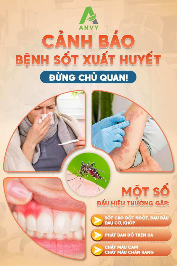 Sốt xuất huyết